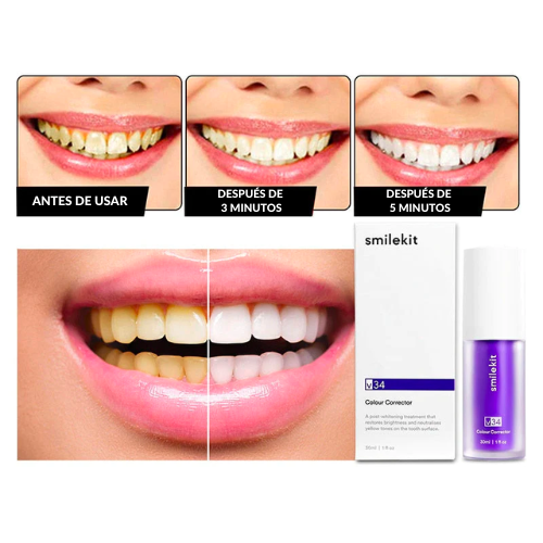 Smilekit™ El nuevo y revolucionario blanqueador dental [OFERTA DE LANZAMIENTO]